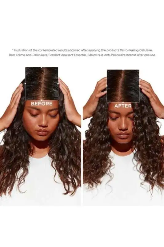 Kerastase Symbiose - Hassas Saç Derisi ve Kepek Sorunu İçin Yoğun Canlandırıcı ve Kepek Karşıtı Saç Maskesi 200ml - 4