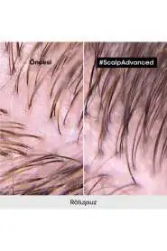LOréal Professionnel Serie Expert Scalp Advanced Yağlanma Karşıtı ve Saç Derisi Dengeleyici Şampuan 500 ml - Sebum Kontrol & Hacim Artışı - 8