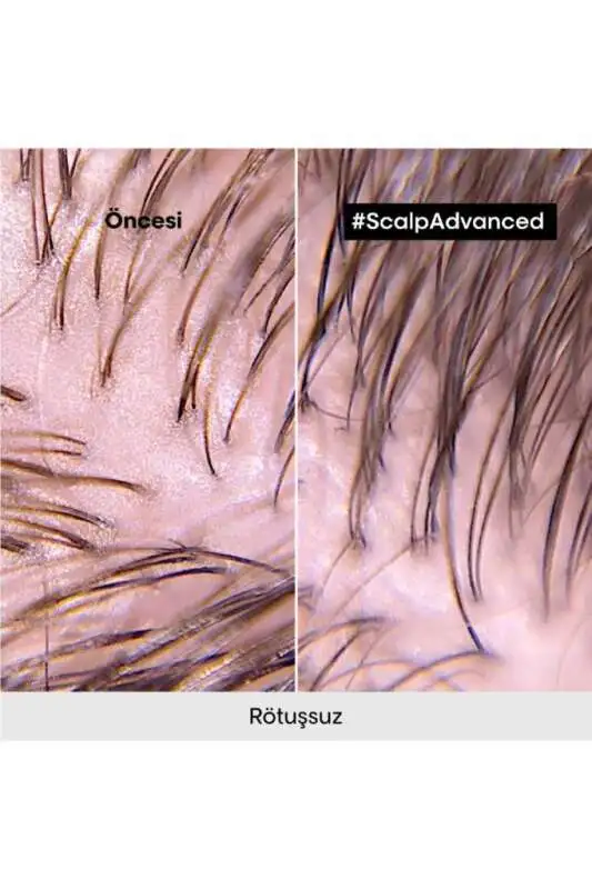 LOréal Professionnel Serie Expert Scalp Advanced Yağlanma Karşıtı ve Saç Derisi Dengeleyici Şampuan 500 ml - Sebum Kontrol & Hacim Artışı - 8