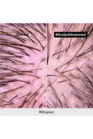 LOréal Professionnel Scalp Advanced Hassas Saç Derisi Bakım Şampuanı - Kaşıntı Önleyici, Hacim Artıran & Nem Dengeleyici 500 ml - 8