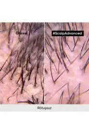 LOréal Professionnel Scalp Advanced Kepek Önleyici Şampuan - Saç Derisi Kaşıntı ve Pullanma Kontrolü 500 ml - 6