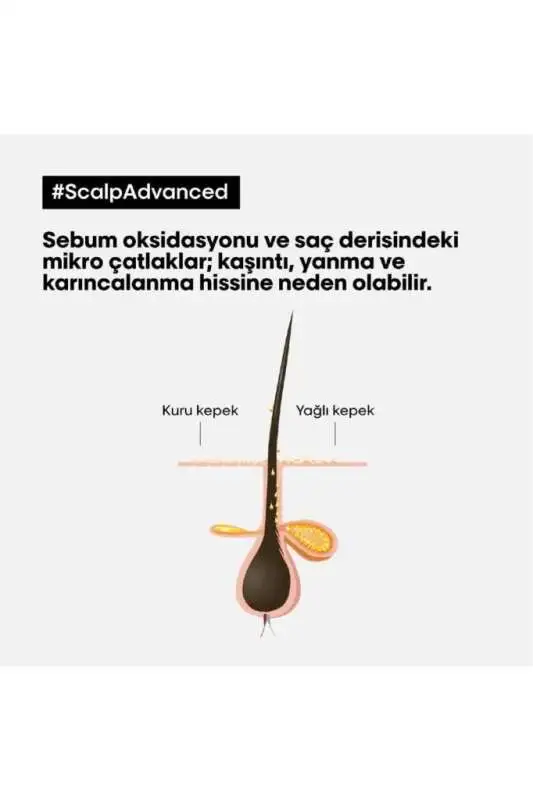 Loreal Professionnel Scalp Advanced Kepek Karşıtı Profesyonel Şampuan 500 ml - 5