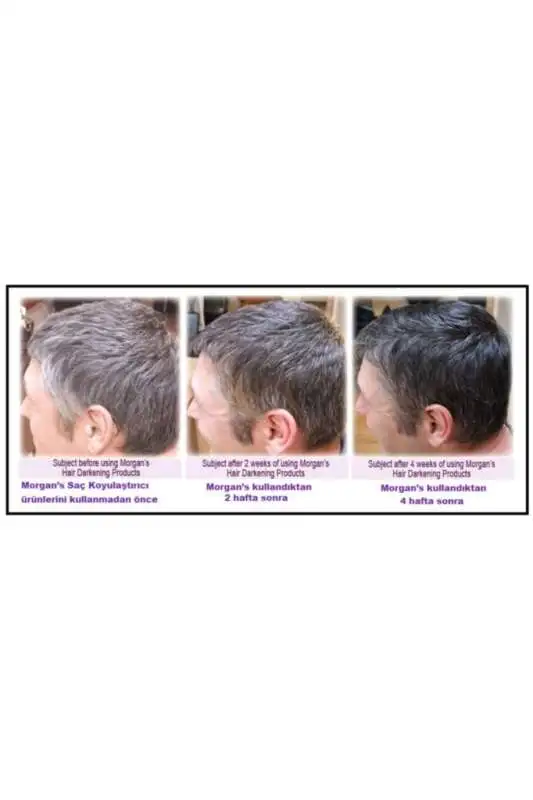 Morgans Pomade Hair Darkening Cream - Gri Örtücü ve Saç Koyulaştırıcı Bakım Kremi 150ml - 5